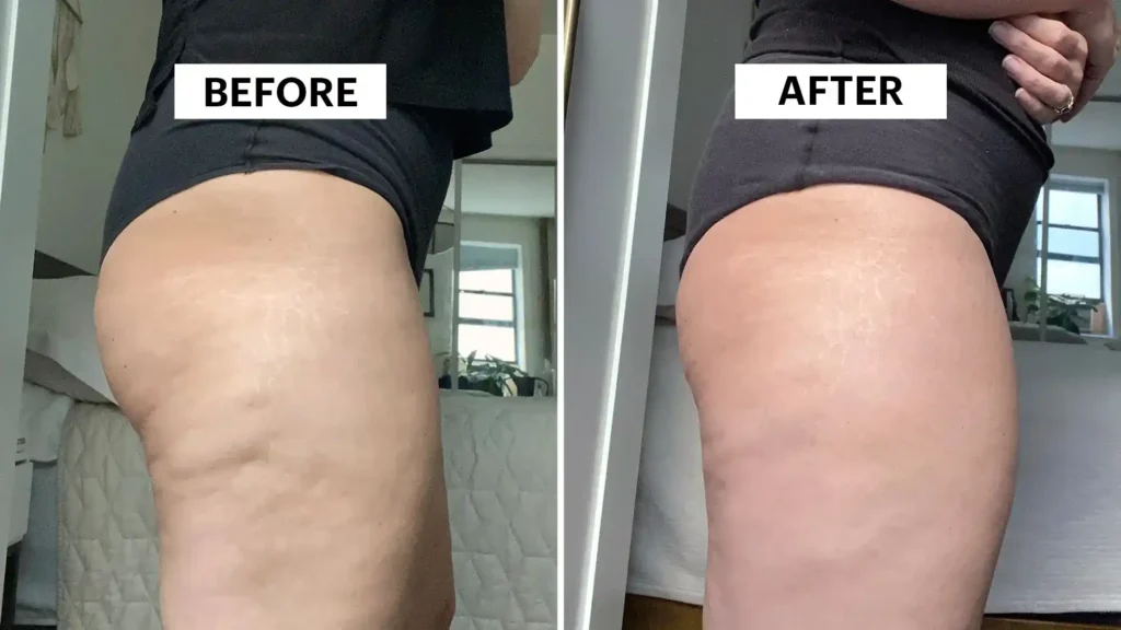 Do Toning Exercise Byfleet Really Tackle Cellulite?